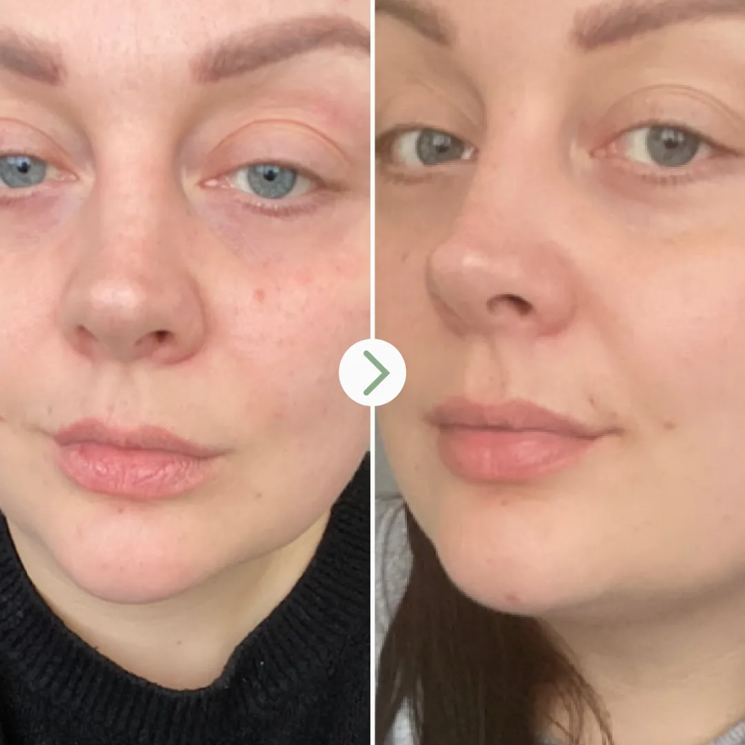 Aceites Faciales<Pai Skincare Rosehip Bioregenerate Face Oil